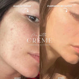 Duo peau nette visage et corps