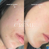 Coffret peau parfaite visage